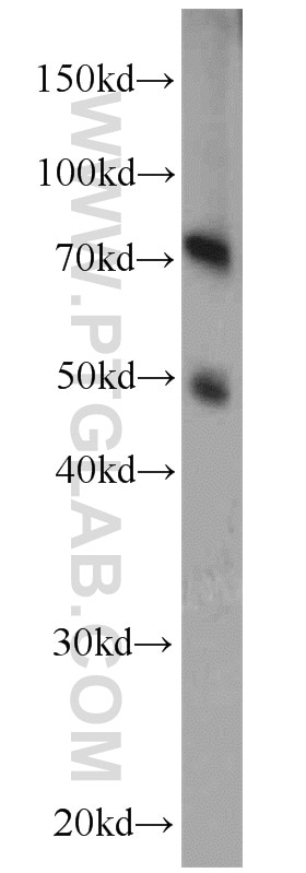 Western Blot (WB) analysis of human testis tissue using ADAM2 Polyclonal antibody (13952-1-AP)