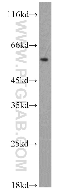 Western Blot (WB) analysis of mouse testis tissue using ADAM2 Polyclonal antibody (13952-1-AP)