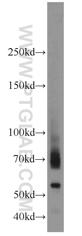 Western Blot (WB) analysis of mouse testis tissue using ADAM2 Polyclonal antibody (13952-1-AP)