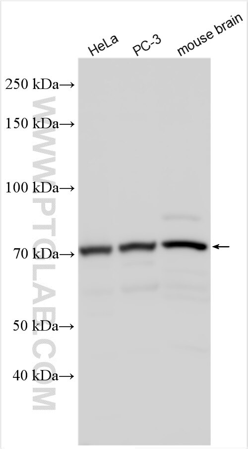 Western Blot (WB) analysis of various lysates using ADAM20 Polyclonal antibody (20755-1-AP)