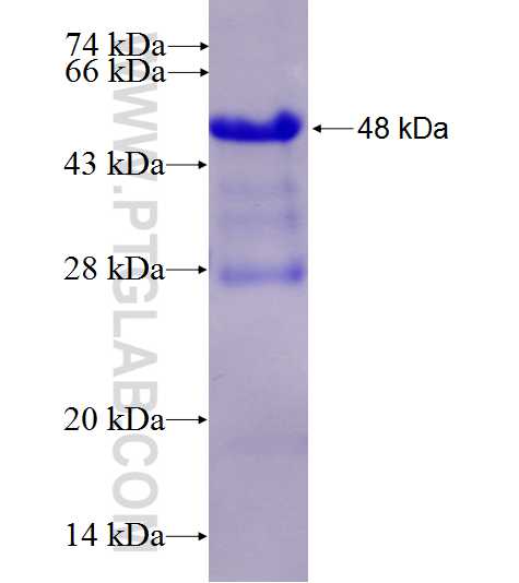ADAM20 fusion protein Ag25814 SDS-PAGE