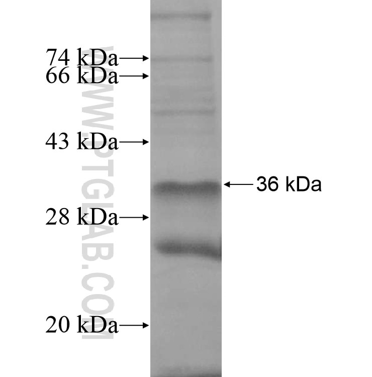 ADAM20 fusion protein Ag14493 SDS-PAGE