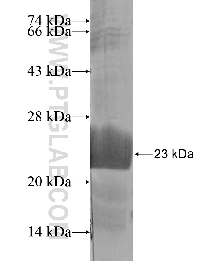 ADAM21 fusion protein Ag17244 SDS-PAGE