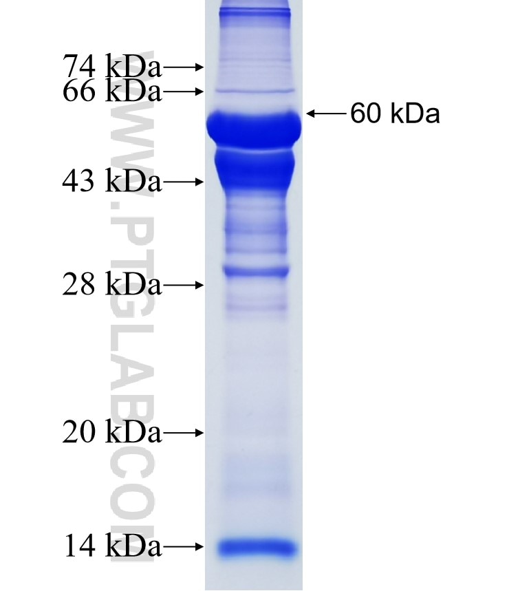 ADAM22 fusion protein Ag5211 SDS-PAGE