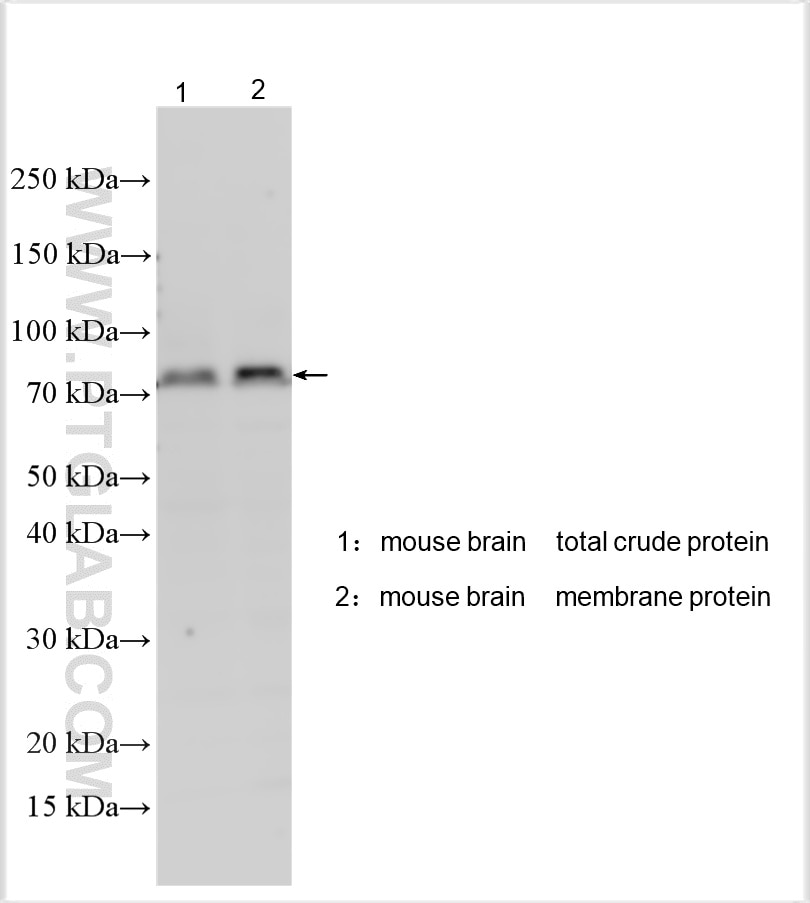 Western Blot (WB) analysis of various lysates using ADAM23 Polyclonal antibody (32969-1-AP)