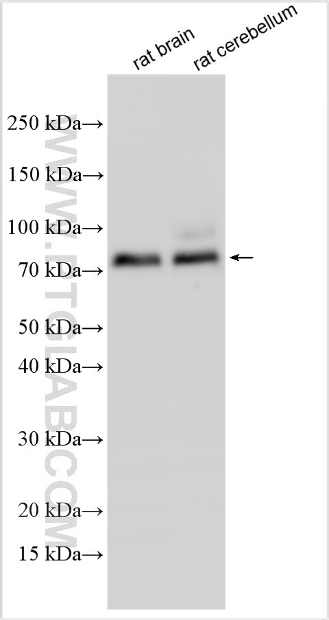 Western Blot (WB) analysis of various lysates using ADAM23 Polyclonal antibody (32969-1-AP)