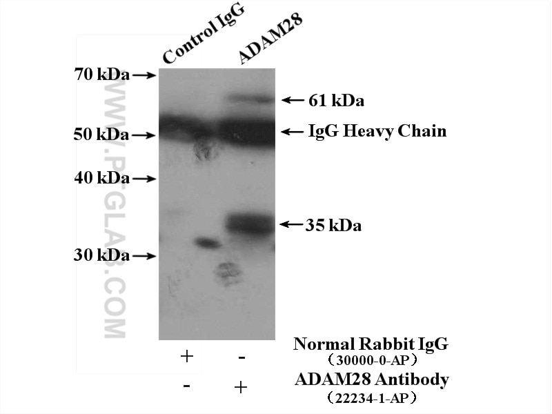 Immunoprecipitation (IP) experiment of mouse lung tissue using ADAM28 Polyclonal antibody (22234-1-AP)