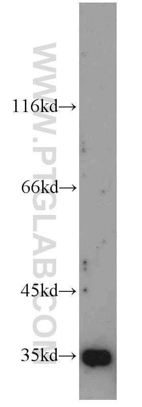 Western Blot (WB) analysis of mouse small intestine tissue using ADAM28 Polyclonal antibody (22234-1-AP)