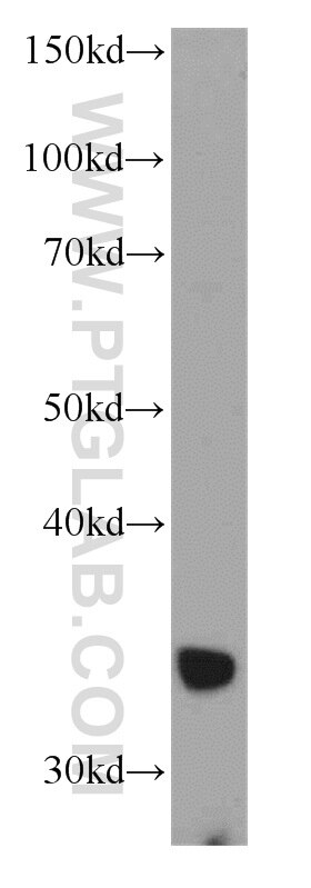 Western Blot (WB) analysis of mouse colon tissue using ADAM28 Polyclonal antibody (22234-1-AP)