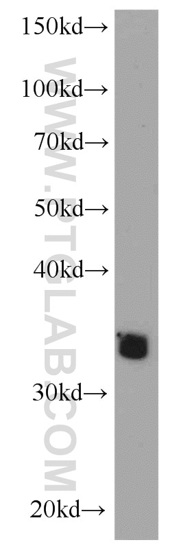 Western Blot (WB) analysis of mouse lung tissue using ADAM28 Polyclonal antibody (22234-1-AP)