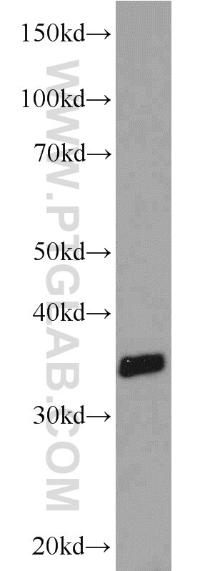 WB analysis of mouse spleen using 22234-1-AP