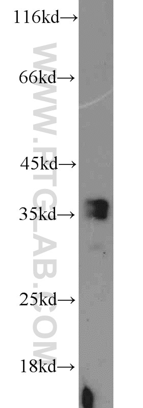 Western Blot (WB) analysis of mouse liver tissue using ADAM28 Polyclonal antibody (22234-1-AP)