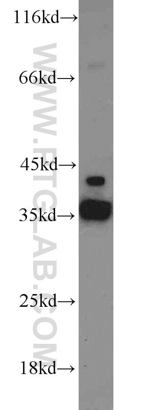 Western Blot (WB) analysis of BxPC-3 cells using ADAM28 Polyclonal antibody (22234-1-AP)