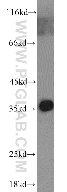 Western Blot (WB) analysis of mouse lung tissue using ADAM28 Polyclonal antibody (22234-1-AP)