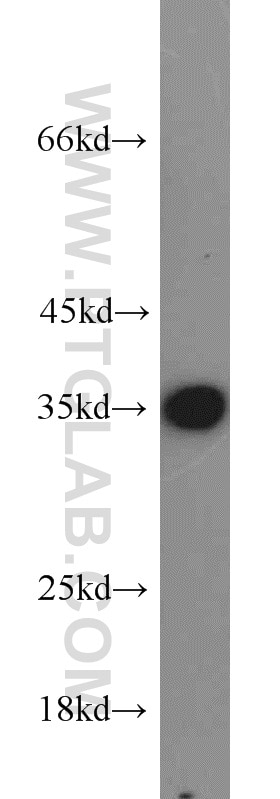 Western Blot (WB) analysis of PC-13 cells using ADAM28 Polyclonal antibody (22234-1-AP)