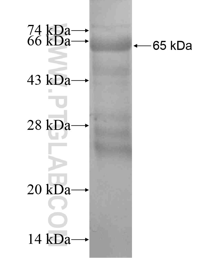 ADAM28 fusion protein Ag17586 SDS-PAGE
