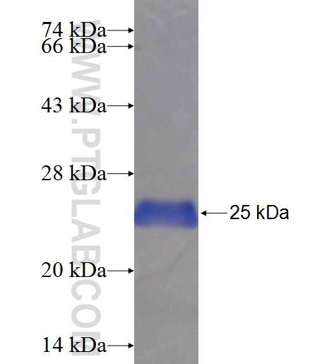 ADAM30 fusion protein Ag24555 SDS-PAGE