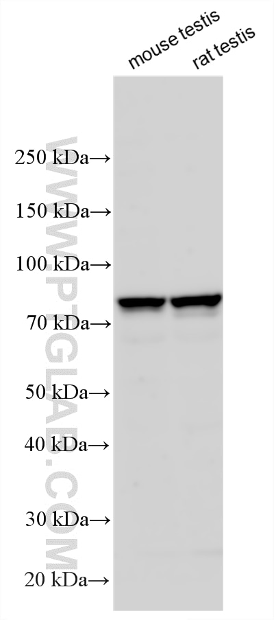 Western Blot (WB) analysis of various lysates using ADAM32 Polyclonal antibody (27530-1-AP)