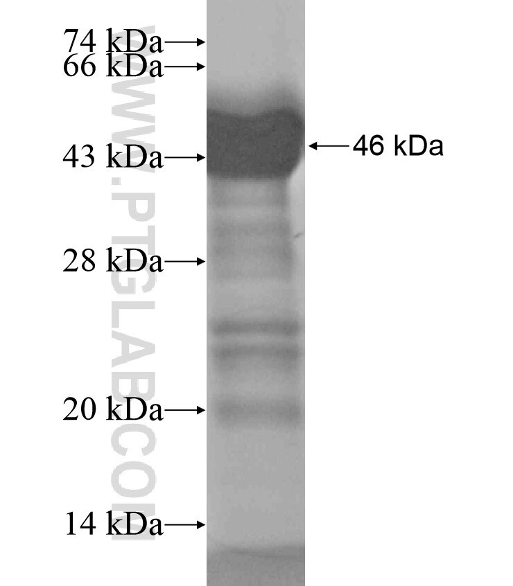 ADAM33 fusion protein Ag18472 SDS-PAGE