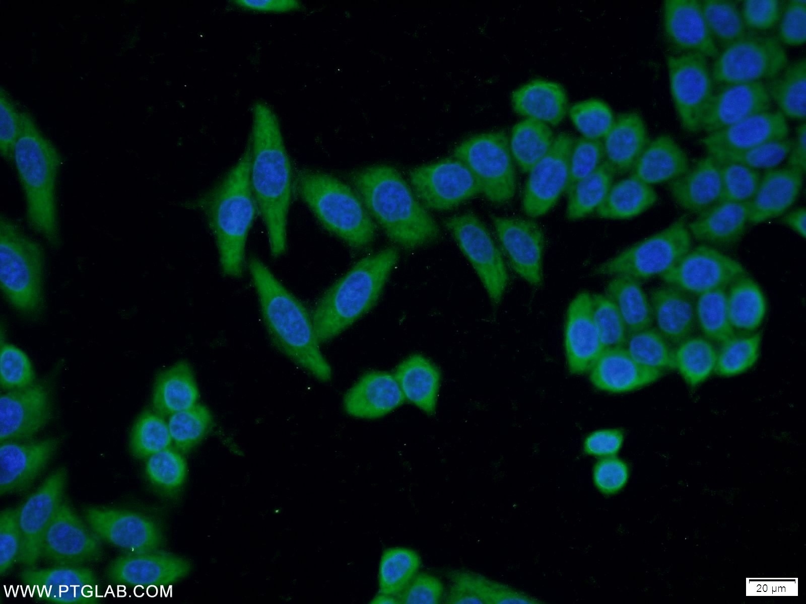 Immunofluorescence (IF) / fluorescent staining of HeLa cells using ADAM5 Polyclonal antibody (22147-1-AP)