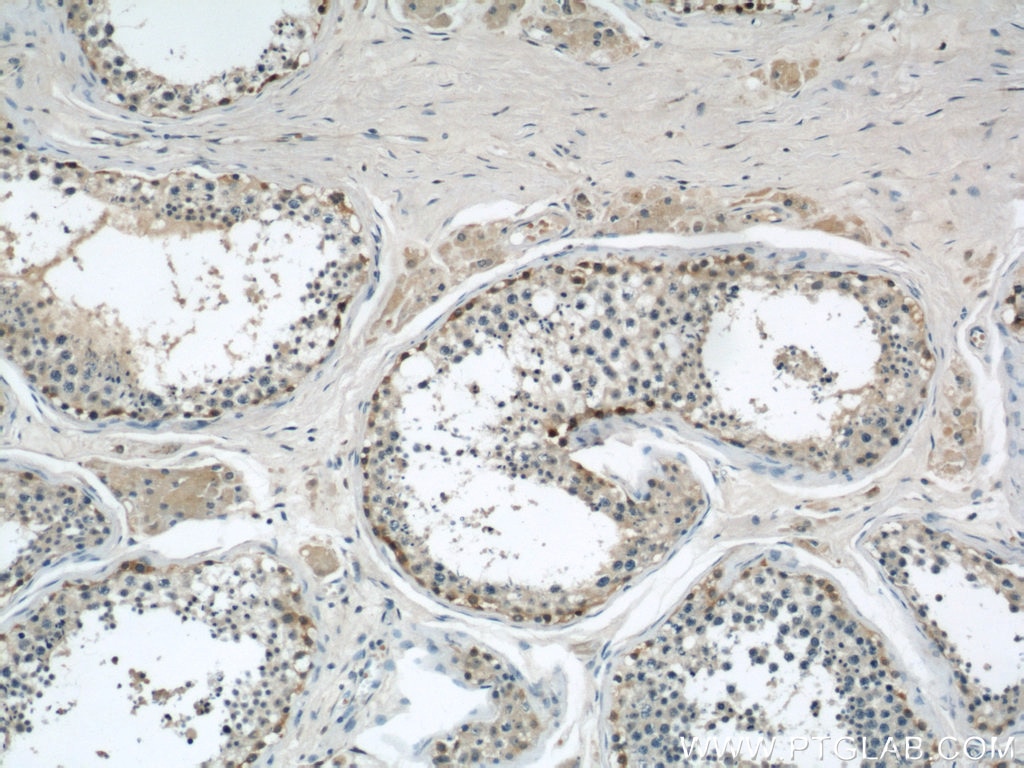 Immunohistochemistry (IHC) staining of human testis tissue using ADAM5 Polyclonal antibody (22147-1-AP)