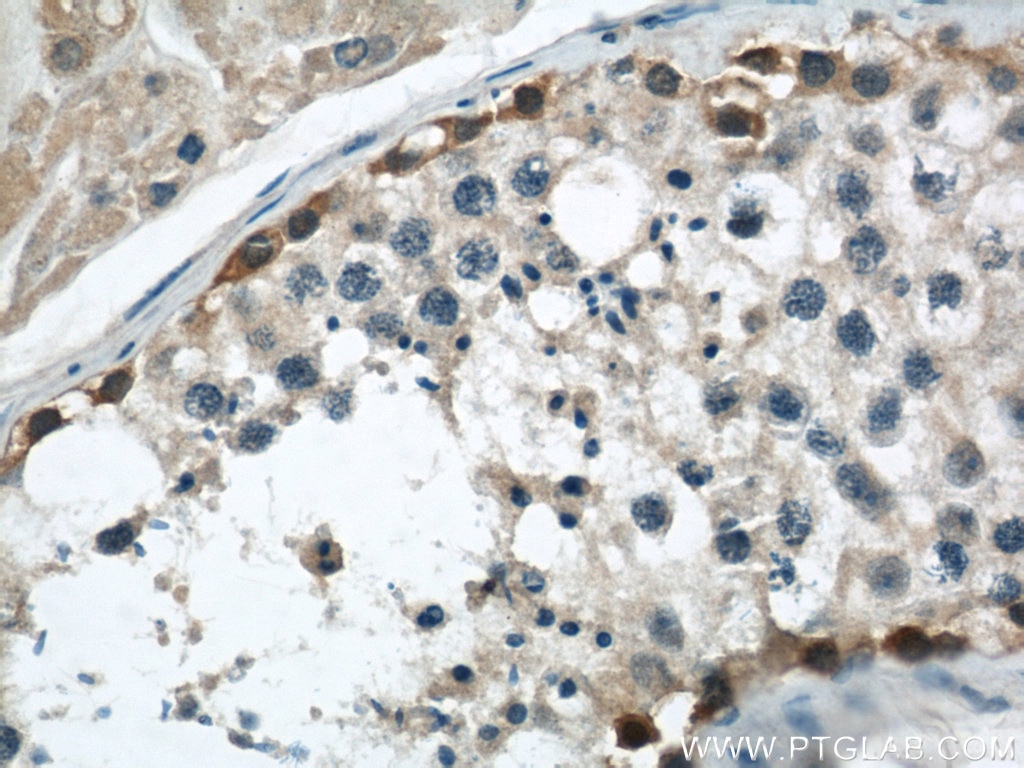 Immunohistochemistry (IHC) staining of human testis tissue using ADAM5 Polyclonal antibody (22147-1-AP)