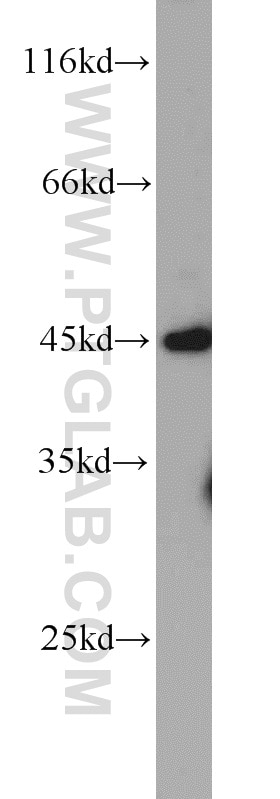 Western Blot (WB) analysis of HeLa cells using ADAM5 Polyclonal antibody (22147-1-AP)