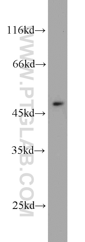 Western Blot (WB) analysis of MCF-7 cells using ADAM5 Polyclonal antibody (22147-1-AP)