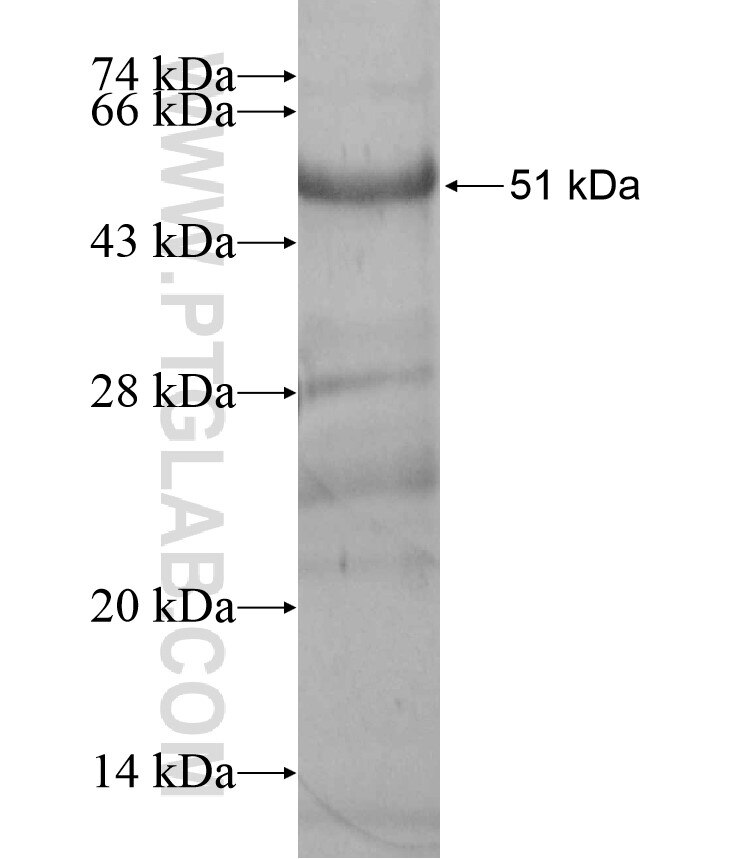 ADAM5P fusion protein Ag17590 SDS-PAGE