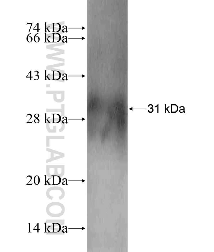 ADAM5P fusion protein Ag18018 SDS-PAGE