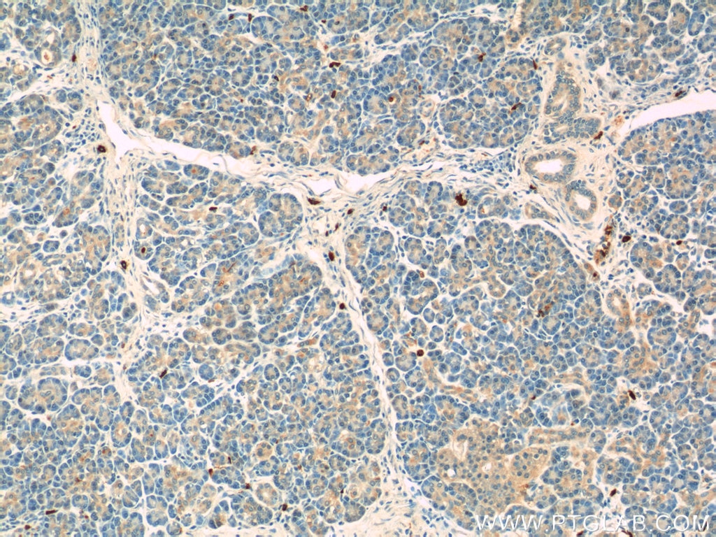 Immunohistochemistry (IHC) staining of human pancreas tissue using ADAM8 Polyclonal antibody (23778-1-AP)