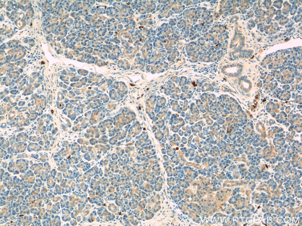 Immunohistochemistry (IHC) staining of human pancreas tissue using ADAM8 Polyclonal antibody (23778-1-AP)