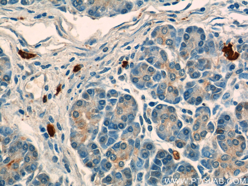 Immunohistochemistry (IHC) staining of human pancreas tissue using ADAM8 Polyclonal antibody (23778-1-AP)