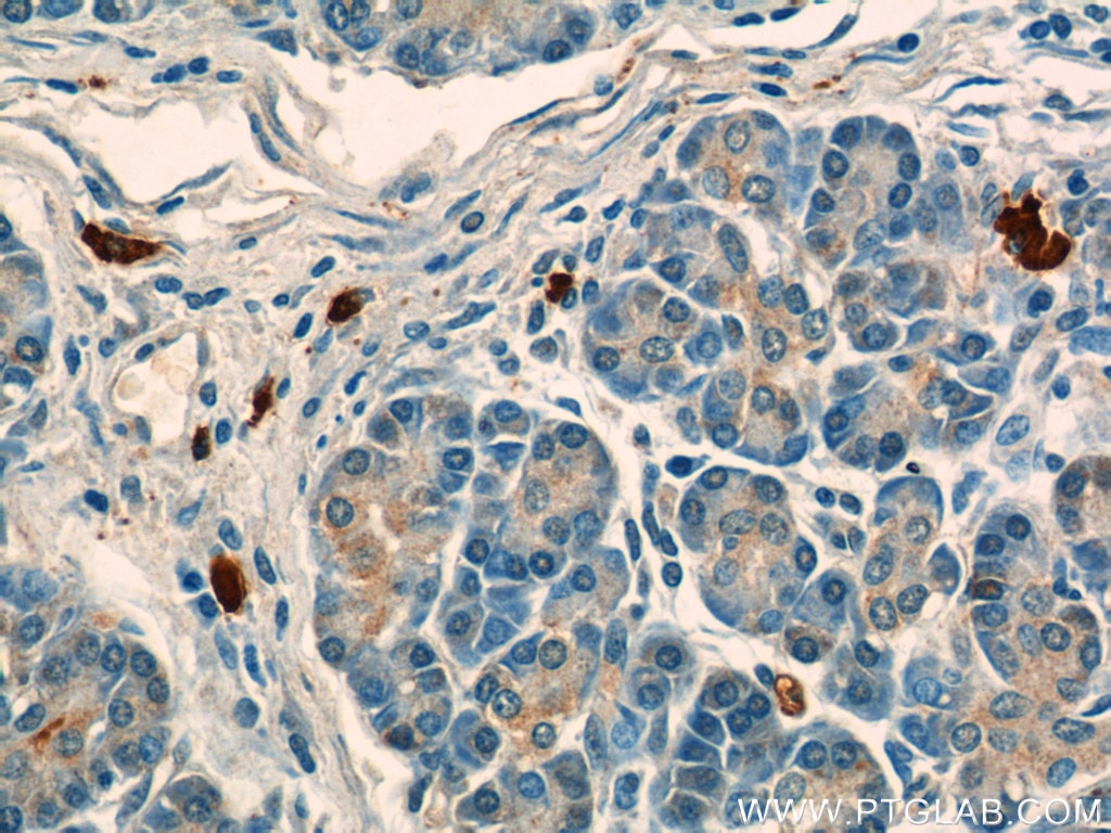 IHC staining of human pancreas using 23778-1-AP