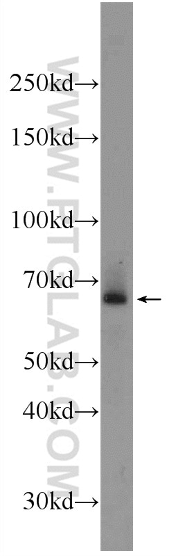 Western Blot (WB) analysis of mouse pancreas tissue using ADAM8 Polyclonal antibody (23778-1-AP)