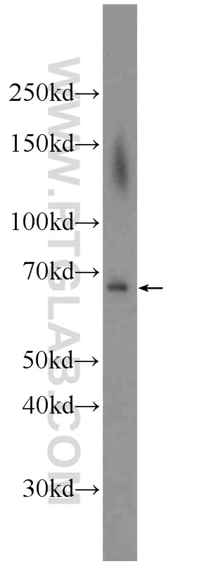 Western Blot (WB) analysis of BxPC-3 cells using ADAM8 Polyclonal antibody (23778-1-AP)