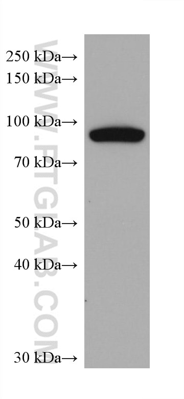 Western Blot (WB) analysis of human testis tissue using ADAM8 Monoclonal antibody (68113-1-Ig)