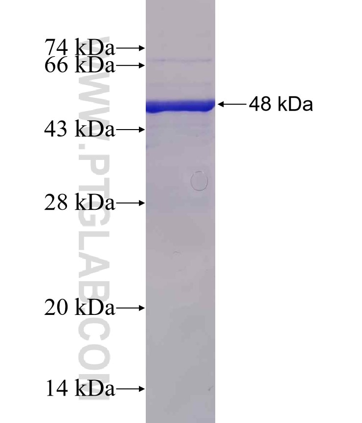 ADAM8 fusion protein Ag30721 SDS-PAGE