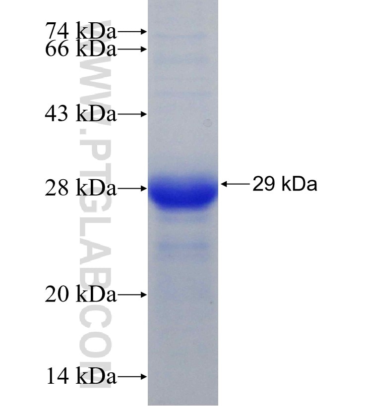 ADAM8 fusion protein Ag30736 SDS-PAGE