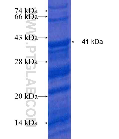 ADAM9 fusion protein Ag20238 SDS-PAGE