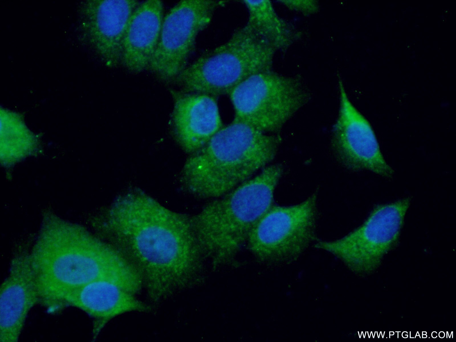 Immunofluorescence (IF) / fluorescent staining of MCF-7 cells using ADAMDEC1 Polyclonal antibody (17899-1-AP)