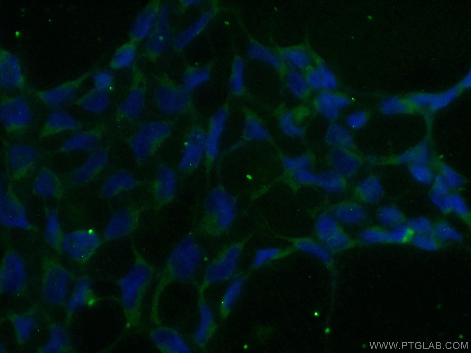 Immunofluorescence (IF) / fluorescent staining of HEK-293 cells using ADAMTS1 Polyclonal antibody (12749-1-AP)