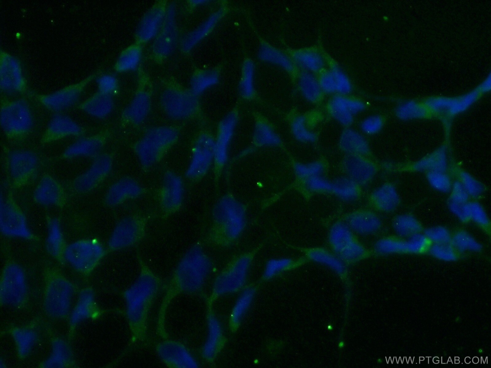 IF Staining of HEK-293 using 12749-1-AP