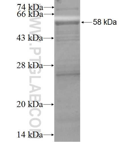 ADAMTS1 fusion protein Ag3485 SDS-PAGE