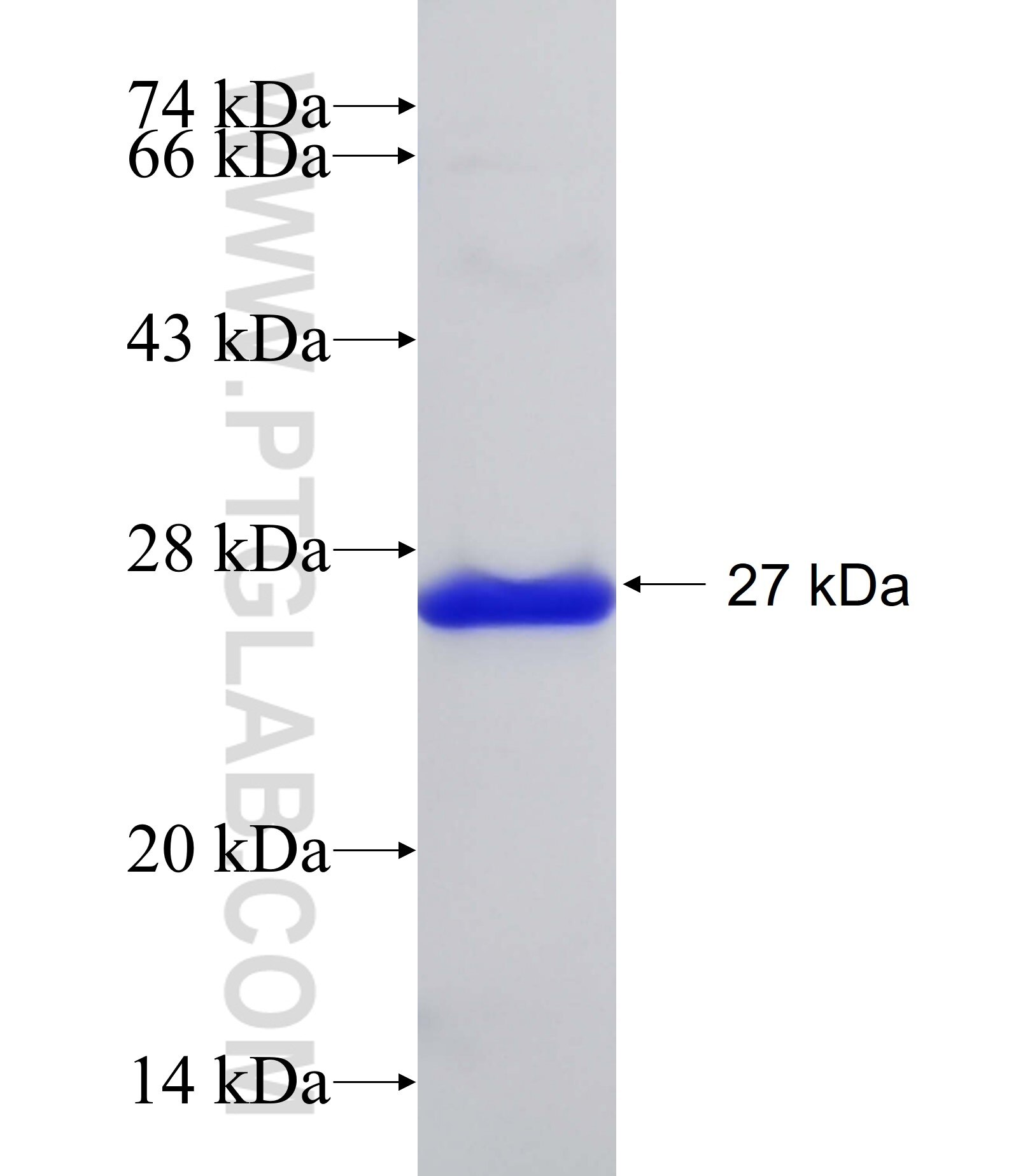 ADAMTS10 fusion protein Ag32012 SDS-PAGE ADAMTS10 fusion protein Ag32012 SDS-PAGE