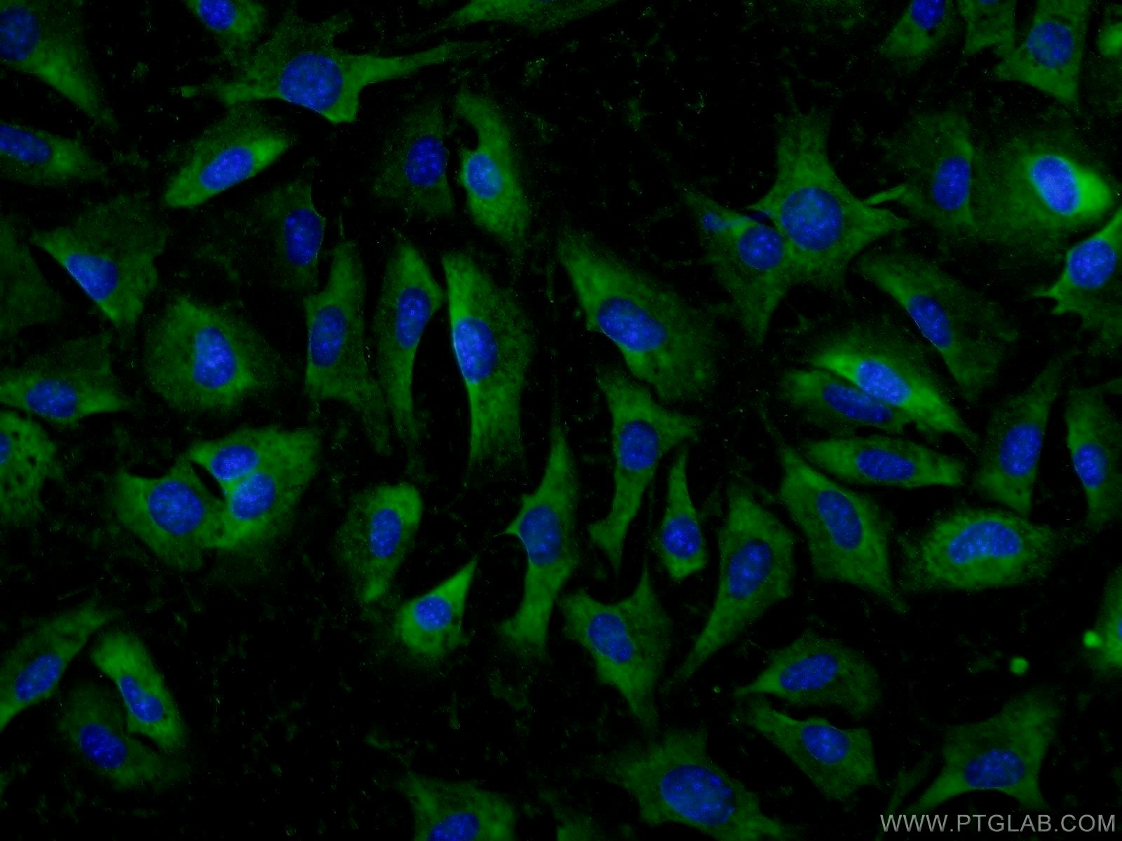 Immunofluorescence (IF) / fluorescent staining of NIH/3T3 cells using ADAMTS12 Polyclonal antibody (24934-1-AP)