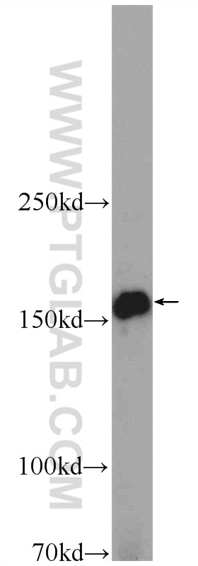 Western Blot (WB) analysis of mouse placenta tissue using ADAMTS12 Polyclonal antibody (24934-1-AP)