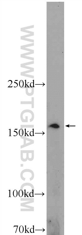 Western Blot (WB) analysis of NIH/3T3 cells using ADAMTS12 Polyclonal antibody (24934-1-AP)