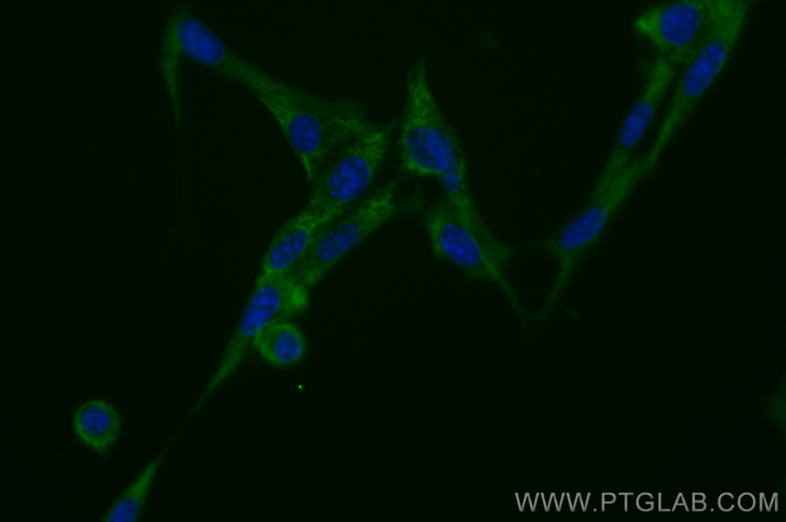 Immunofluorescence (IF) / fluorescent staining of NIH/3T3 cells using CoraLite® Plus 488-conjugated ADAMTS12 Polyclonal  (CL488-24934)