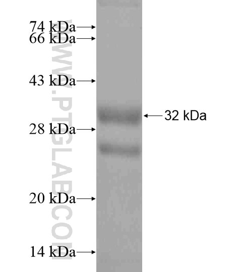 ADAMTS12 fusion protein Ag20712 SDS-PAGE
